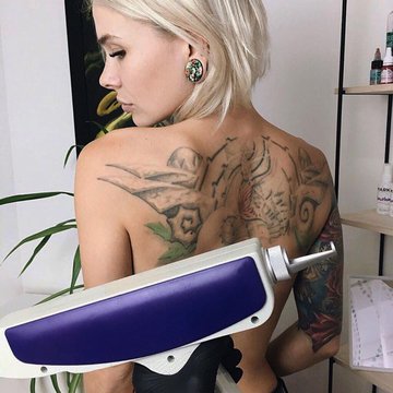 Видалення тату у Львові