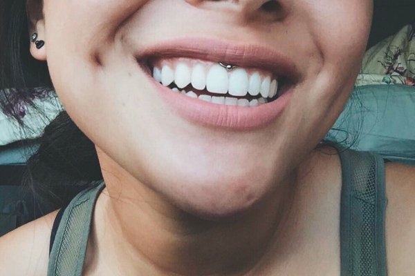 Пірсинг смайл