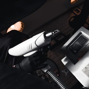 Видалення тату в Кривому Розі