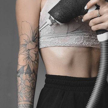 Видалення татуювань у Дніпрі