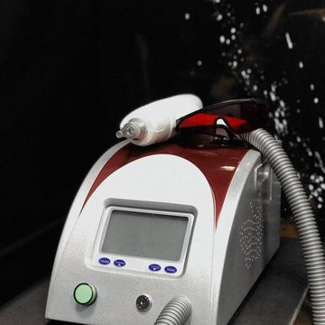 Видалення тату в Кривому Розі