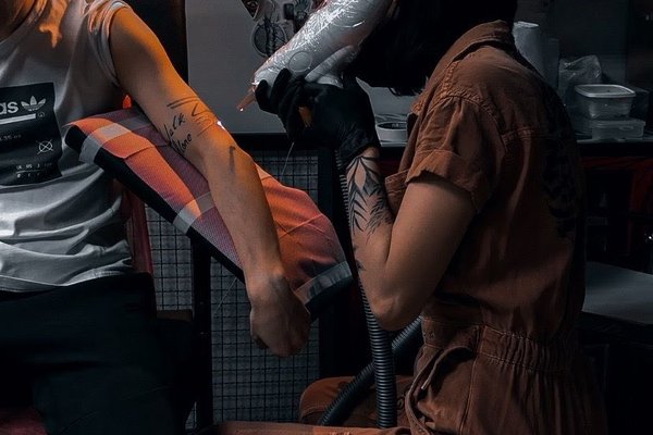 Laser tattoo removal in Dubno