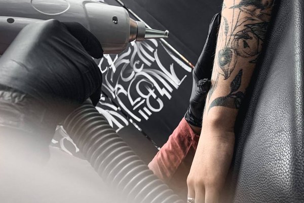 Видалення татуювань у Дніпрі