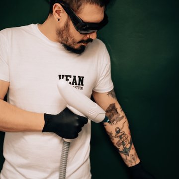 Видалення тату в Кривому Розі