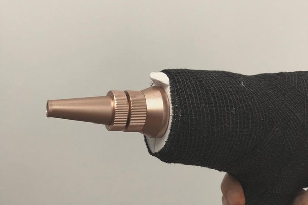 Лазерне видалення тату в Дубно