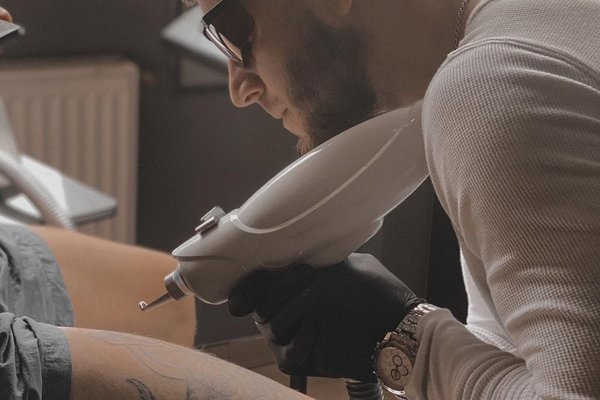 Laser tattoo removal in Dubno