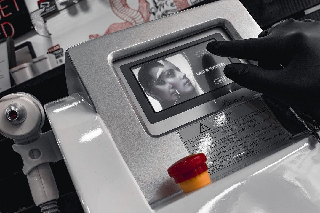 Laser removal of permanent makeup in Kolomyia