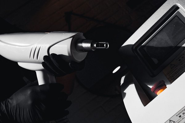 Удаление татужа в  Коломые