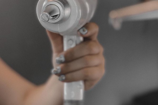 Удаление татужа в  Коломые