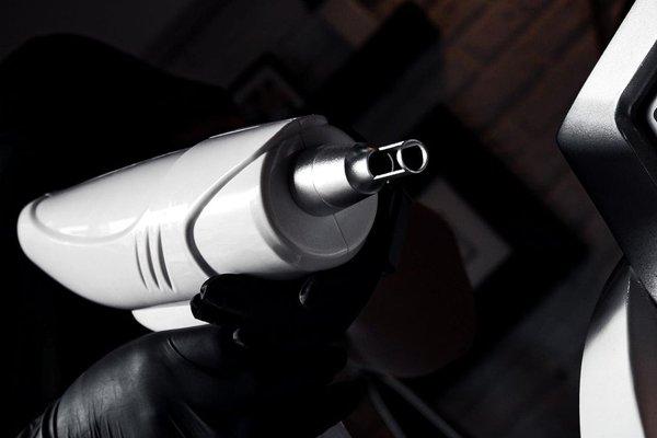 Удаление татужа в  Коломые