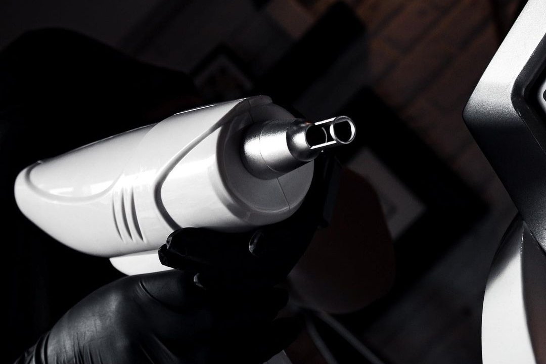 Лазерное удаление татуажа в Дубно