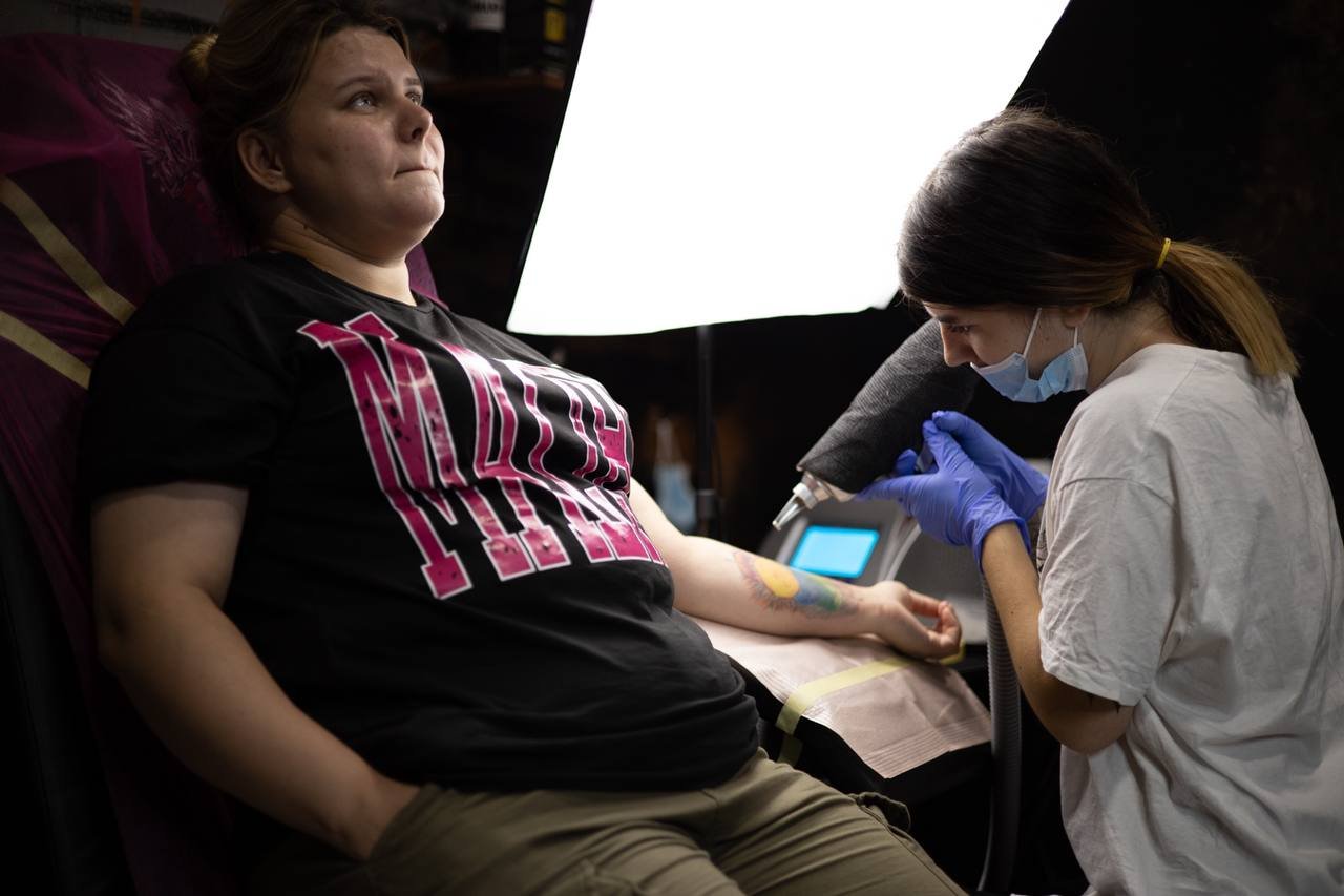 Видалення тату в Коломиї