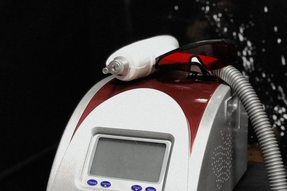 Видалення тату в Коломиї