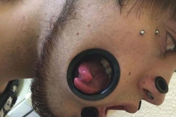 Тунелі в щоках