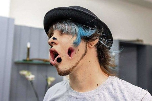 Тунелі в щоках