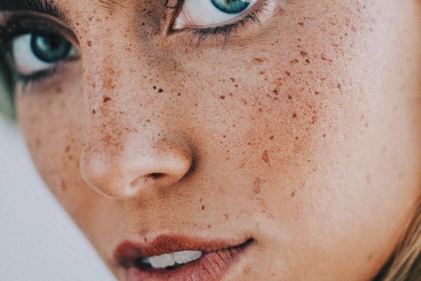 Татуаж веснушек