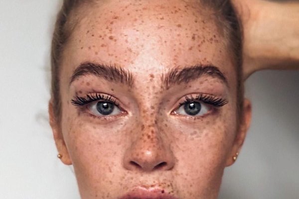 Татуаж веснянок