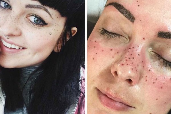 Татуаж веснянок