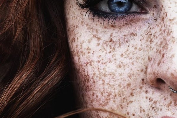 Татуаж веснянок