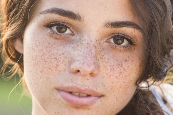 Татуаж веснушек