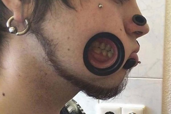 Тунелі в щоках