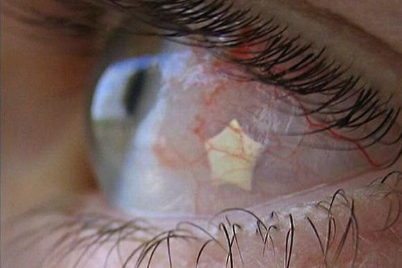 Пірсинг очей