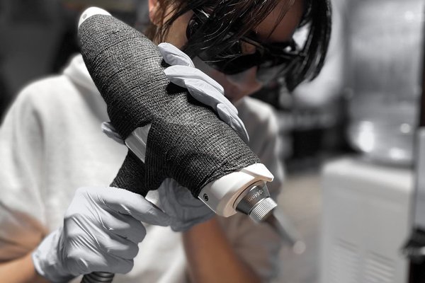 Видалення тату в Ірпені