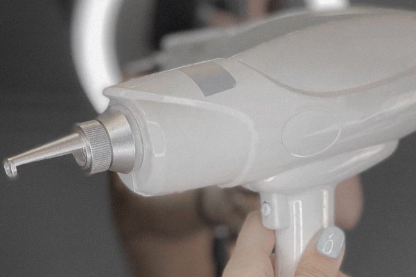 Видалення татуажу в Ірпені