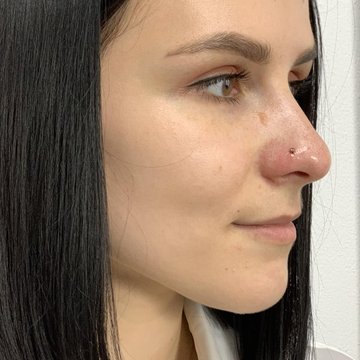 Пірсинг у Черкасах