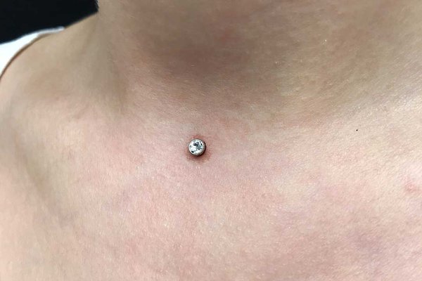 Пірсинг мікродермал