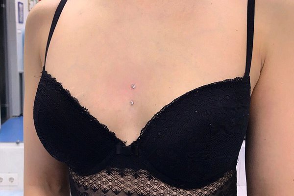 Пірсинг мікродермал