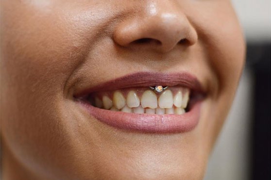 Пірсинг смайл