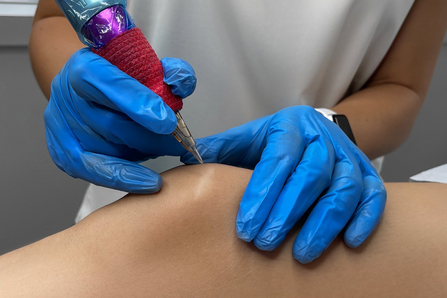 Татуаж на шрамах и рубцах