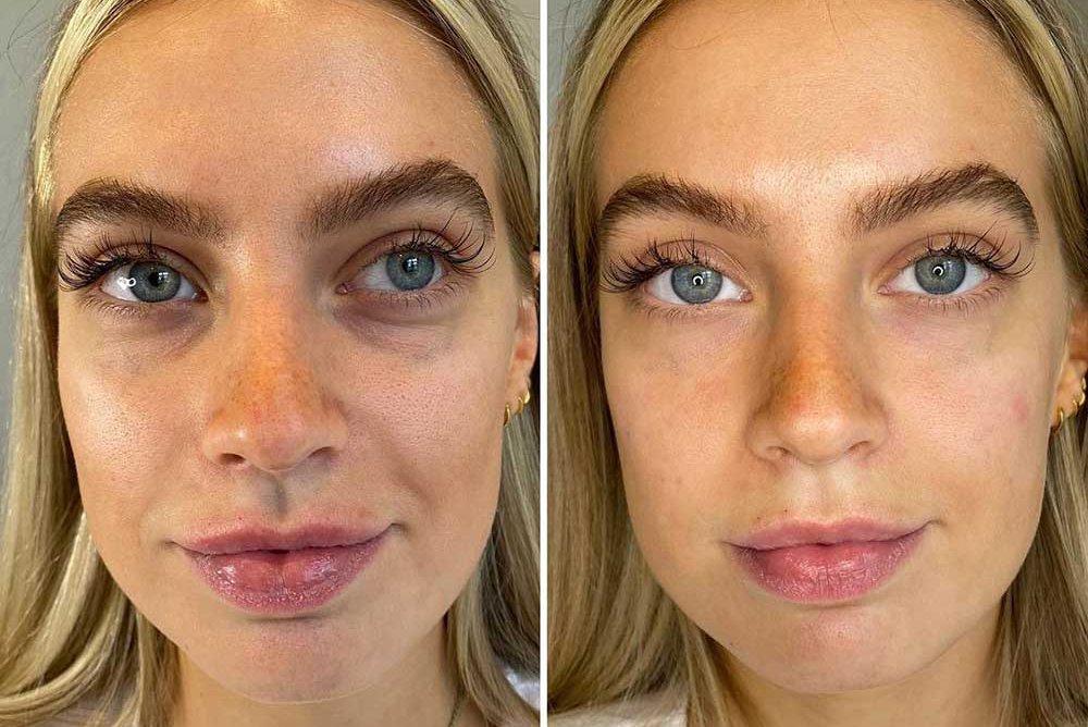 Татуаж кіл під очима