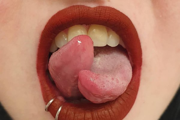 молодежный сплит