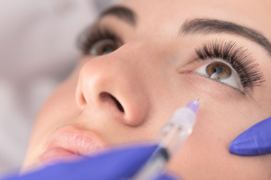 Татуаж кругов под глазами