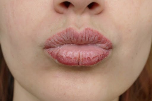 как заживает перманентный макияж