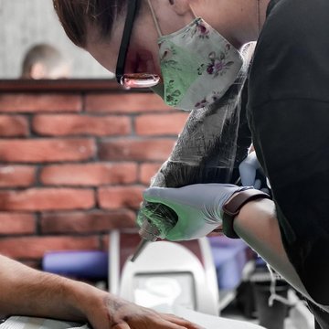 Laser tattoo removal in Kiev