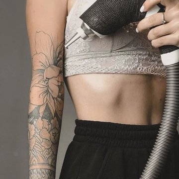 Laser tattoo removal in Kiev