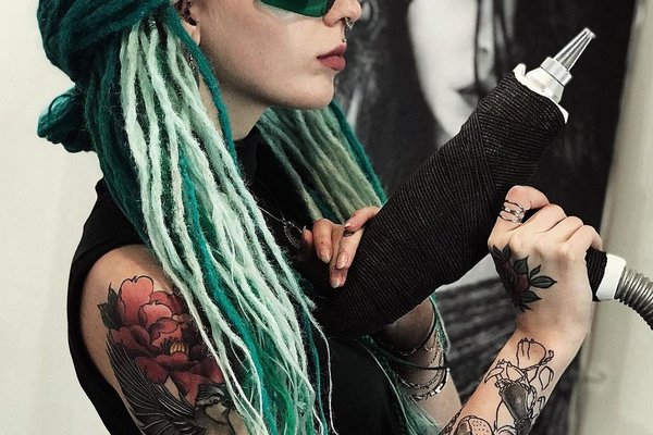 Laser tattoo removal in Kiev